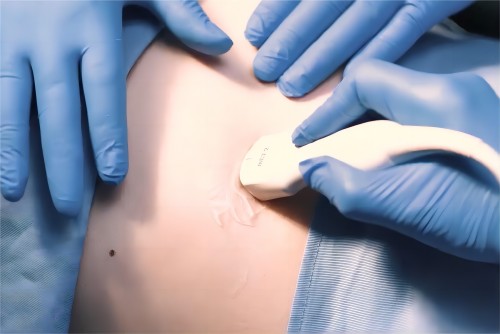 孕早期做超聲檢查次數要多少次？—平創醫療